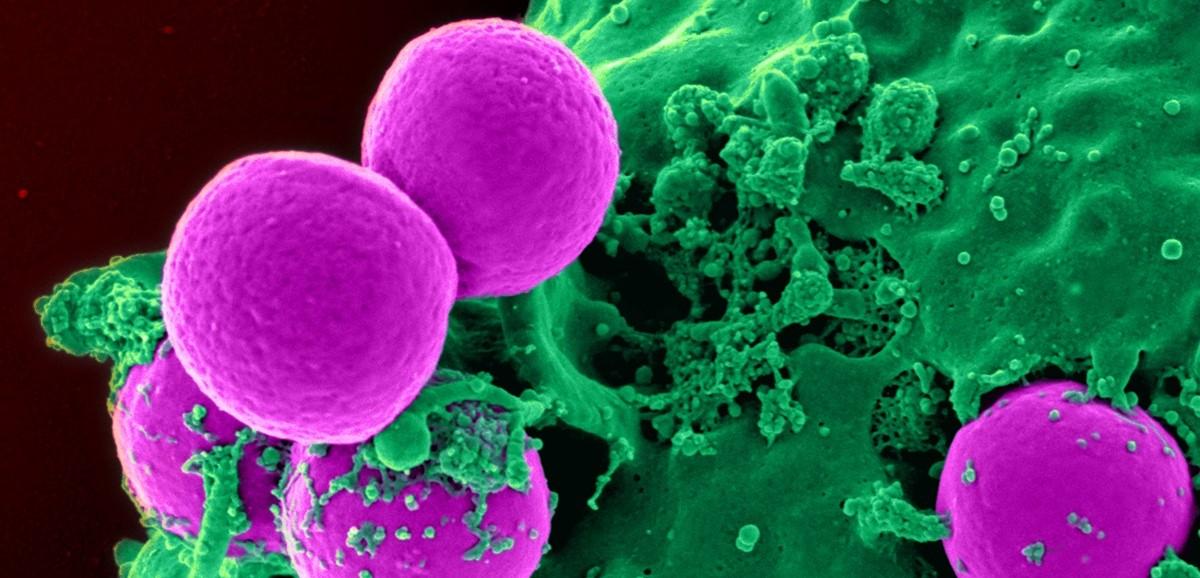 Wo herkömmliche Medikamente versagen: Antibiotika-resistente Bakterien. Kolorierte elektronenmikroskopische Aufnahme. Bild: CDC/NIAID